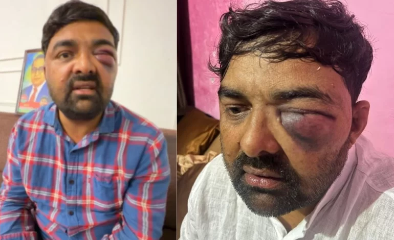 मेरठ SSP पर किसान नेताओं को पीटने के गंभीर आरोप, SOG ऑफिस में भी दी गई यातनाए