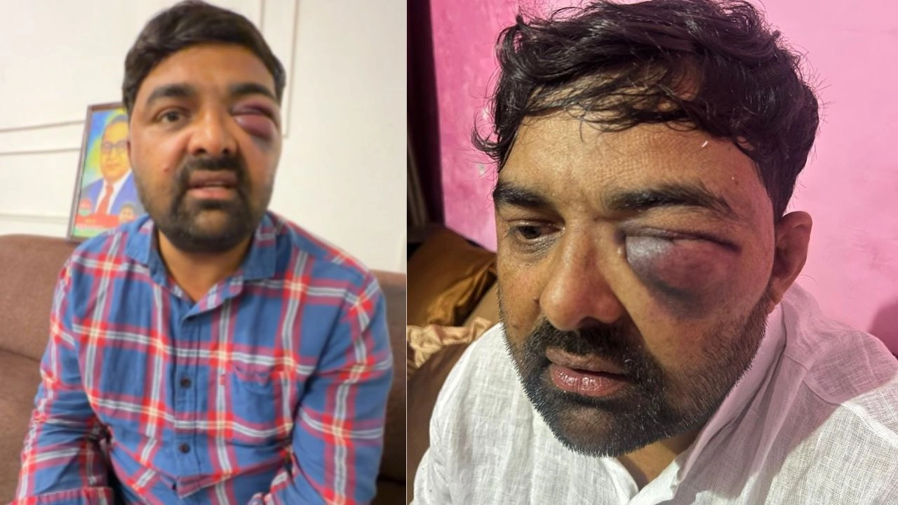मेरठ SSP पर किसान नेताओं को पीटने के गंभीर आरोप, SOG ऑफिस में भी दी गई यातनाए